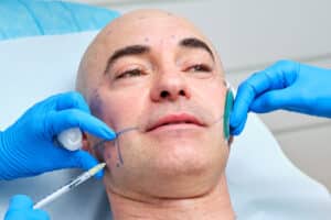 Men's Facelift | Male Facelift for a Youthful, Masculine Look