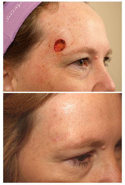 Reconstruction Surgery - Restore Function and Appearance