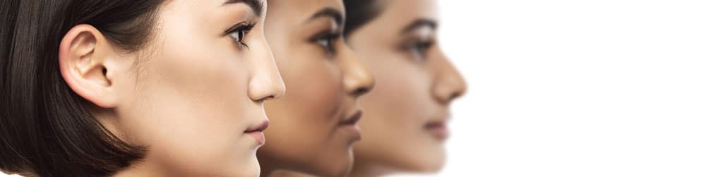 Rhinoplasty Success Stories - Rhinoplasty Austin
