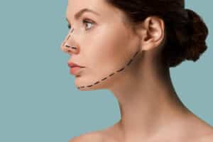 Chin Implant Procedure | Achieve a Defined Jawline with a Chin Implant