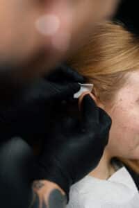 Otoplasty Procedure | Enhance Ear Shape with Otoplasty Surgery